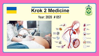 Krok 2 Medicine  Year 2020  057 Ministry of Public Health of Ukraine [upl. by Dru]