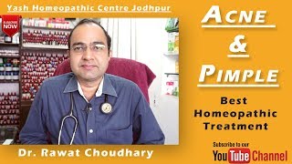 Acne and Pimple Best Homeopathic Treatment  Yash Homeopathic Centre Jodhpur [upl. by Ailegna]