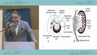 Ovarian Cancer From Pathogenesis to Effective Treatment [upl. by Yelnet]