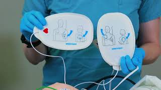 Synchronized Cardioversion [upl. by Bray]