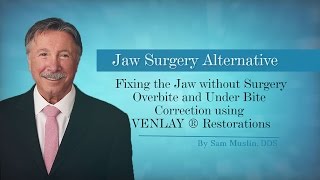 NonSurgical Overbite amp Underbite Fix with VENLAY® Restorations [upl. by Nnaitak]