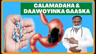 GAASKA CALOSHA amp MIDHICIRAHA CALAMALADAHA LAGU GARTO amp DAWEYNTISA PUPTIC ULCER DR MAHAMED LABAN [upl. by Milissent]