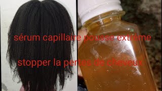 SÉRUM CAPILLAIRE POUSSE CHEVEUX STOPPER LA PERTES DE CHEVEUX 😭😱 [upl. by Nooj]