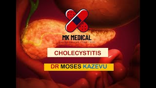 Cholecystitis [upl. by Raffaello706]