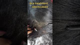 How to remove nits and lice nits ytshorts hair headlice peenu haircare eeru removal lice [upl. by Motteo37]