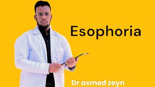 esophoria [upl. by Lamaaj]