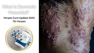 What is Zoonotic Potential Herpes Cure Update 2025  TEI Herpes [upl. by Tnattirb]