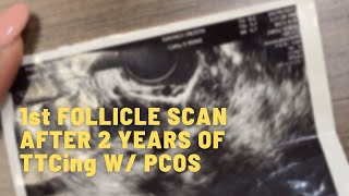 CYCLE DAY 9 FOLLICLE SCAN WITH LETROZOLE  TTC JOURNEY WITH PCOS  Baby 1 [upl. by Anicart]