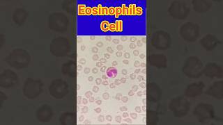 Eosinophils cells  Blood smear  Blood smear microscopy  shorts trendingshorts viral lab [upl. by Prunella50]