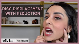 Disc Displacement With Reduction  Priya Mistry DDS the TMJ doc tmj jawpopping jawclicking [upl. by Robina]