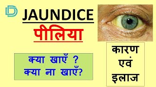 Jaundice  Types Causes Symptoms amp Treatment  Bilirubin Metabolism  Icterus [upl. by Koenig]