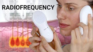 Radiofrequency Skin Tightening Treatments  Do They Really Work amp If So How Nebulyft Science [upl. by Ecniv]