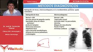 Tromboembolismo pulmonar  Neumología  Resumen más completo [upl. by Seibold]