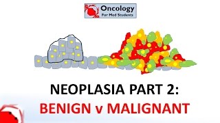 2 Neoplasia part 2 Differences between benign and malignant neoplasms [upl. by Odilo]