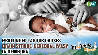 PROLONGED LABOUR CAUSES BRAIN STROKECEREBRAL PALSY IN NEWBORN [upl. by Gerrard407]