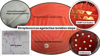 Streptococcus agalactiae Identification stepsGram stainBacitracin susceptibility CAMPAntibiogram [upl. by Yanal581]