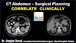 Correlate Clinically  Abdomen Imaging  CT scan abdomen interpretation  Radiology masterclass [upl. by Delos]