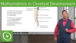 Malformations in Cerebellar Development – Embryology  Lecturio [upl. by Nanreh]