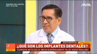 Implantes Dentales en 1 cita [upl. by Monsour]