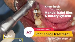 How Root canal treatment  RCT is done  Know both Manual and Rotary system [upl. by Luzader]