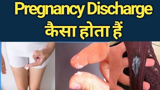 Pregnancy Discharge kaisa hota hai🥺 Normal Discharge aur Pregnancy Discharge me Sabse bada ferk ye h [upl. by Angus]