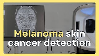 Melanoma skin cancer breakthrough technology for early detection  Conquering Skin Cancer [upl. by Llerdnam431]