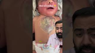 Doctor Reacts To Baby With Exposed Heart [upl. by Dniren983]