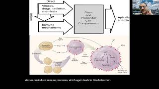 6 Pancytopenia Diagnosis Approach and Treatment of Aplastic Anaemia 27th April 2022 [upl. by Merci]