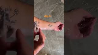 Tattoo healing day 5 saniderm removal [upl. by Dranik]