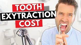 Cost of a Tooth Extraction  Teeth Extractions [upl. by Endaira]