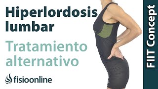 Hiperlordosis lumbar  Visión desde la fisioterapia y la medicina natural [upl. by Ais969]