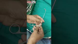 MAXILLARY ANTRUM GRASPING ROTATING FORCEPS  goviral shortfeed viralreels [upl. by Martica747]