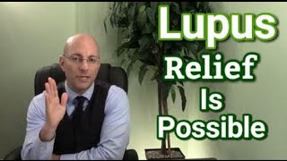 Lupus Treatment And Symptoms  Causes Of Connective Tissue Disease [upl. by Zoilla]