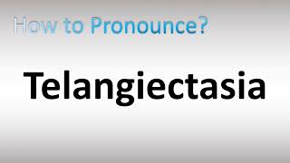 How to Pronounce Telangiectasia [upl. by Ylla427]