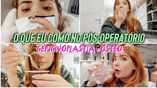 O QUE EU COMO EM 1 DIA de pósoperatório GENGIVOPLASTIA  OSTEOTOMIA [upl. by Cordy]