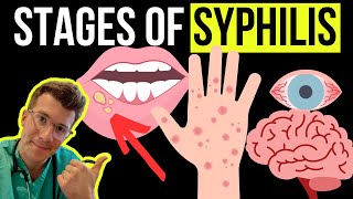 Doctor explains the Symptoms and Stages of SYPHILIS STI [upl. by Tristan]