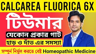 Calcarea Fluorica 6x  Calcarea Fluorica 12x Homeopathic Medicine  টিউমার হোমিওপ্যাথি চিকিৎসা [upl. by Bevvy]