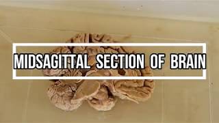 Lobes of the Brain Cerebrum Anatomy and Function Cerebral Cortex [upl. by Josiah885]