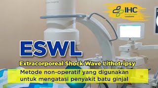 Tentang ESWL  Extracorporeal Shock Wave Lithotripsy [upl. by Alcine]