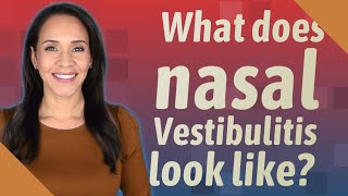 What does nasal Vestibulitis look like [upl. by Assilanna804]