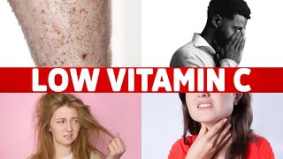 8 Signs of a Vitamin C Deficiency Youve Never Heard About [upl. by Prem]