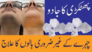 Face Hair Removal  How to remove hair from face  Face hair removal for women at home [upl. by Nasar]