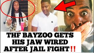 THF Bayzoo Gets His Jaw Wired After Fight In Jail The Video Leaked On The Net Was THF Zoo Lying [upl. by Wivinia653]