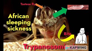 Trypanosomiasis I African sleeping sickness I Trypanosoma brucei gambiense amp rhodesiense I [upl. by Bocyaj671]