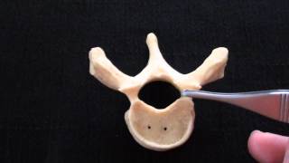 Typical Vertebra  Spinal column  Anatomy [upl. by Alomeda]