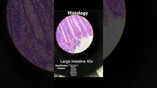 ANATOMY  HISTOLOGY  LARGE INTESTINES  IDENTIFICATION FEATURES mbbs anatomy life histology [upl. by Aniri793]