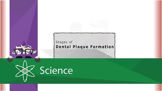 Stages of Dental Plaque Formation [upl. by Ynohtnanhoj]