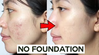 How to Cover Acne amp Blemishes WITHOUT Foundation • easy amp non cakey [upl. by Nairdad120]