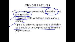 chronic hyperplastic pulpitis [upl. by Enelyt]