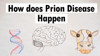 Prion Disease  How does Prion Disease Happen [upl. by Eenram]